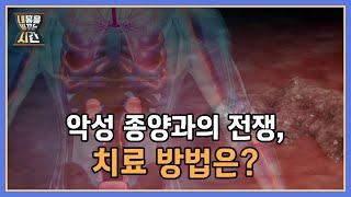 생명과 직결 악성 종양과의 전쟁 치료 방법은? MBN 220911 방송