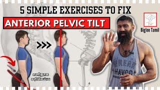 Anterior pelvic tilt   5 exercises to fix  postural correction   Biglee Tamil