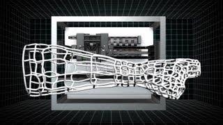 3D printed cortex cast  takes the itch out of healing broken bones