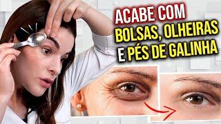 USE 1 COLHER e ACABE com Pés de Galinha Bolsas e Olheiras 