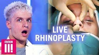 Would You Have A Nose Job After Watching This?  Plastic Surgery Undressed