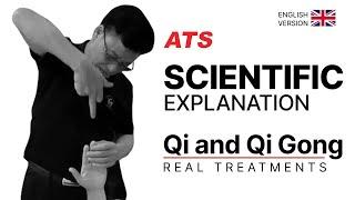 Scientific Explanation of Qi and Qi Gong - Master Dr. Zhou Real Treatments and Demonstrations