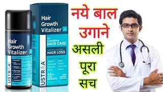 Ustra Hair Growth Vitalizer HONEST Review 2023 in hindi  Results Uses Benefits Uses price info