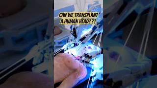 Human head transplant machine