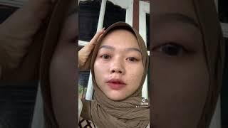 Review jujur pemakaian ms glow acne 