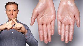 How to Stop Excessive Sweating Hyperhidrosis