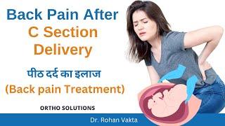 Back Pain After C Section Delivery डिलीवरी के बाद कमर दर्द Back Pain का कारण और इलाज