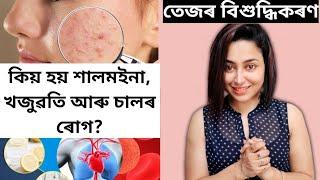 How To Purify Blood At Home?  Blood Purification For Skin  Assamese General Knowledge