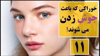 ۱۱ خوراکی که باعث جوش زدن می شوند