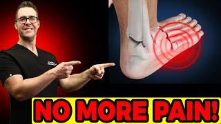 Hairline Stress Fracture in the Foot? Symptoms & Best TREATMENT