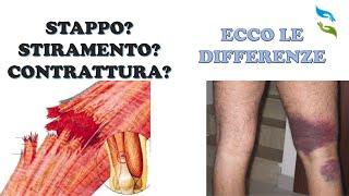 Contrattura stiramento o strappo muscolare? Ecco come distinguere.