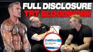 My TRT  Testosterone Protocol Reviewed by Doctor Free Testosterone SHBG DHT Estradiol & More…