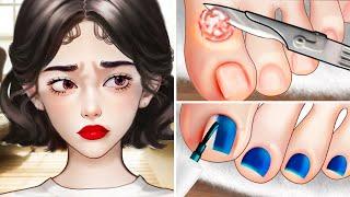 ASMR Nail Care Ingrown Toenail Removal and Nail Polish  ASMR Ingrown Nail Treatment