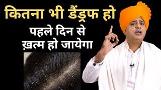 डैंड्रफ जड़ से ख़त्म करने के लिए Get Rid of Dandruff Permanently  Sanyasi Ayurveda 