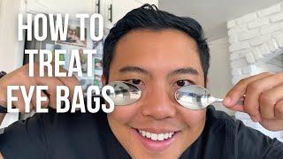 How to get rid of UNDER EYE BAGS FAST the SAFEST ways   Ophthalmologist @michaelchuamd
