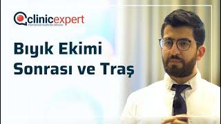 Bıyık Ekimi Sonrası ve Traş