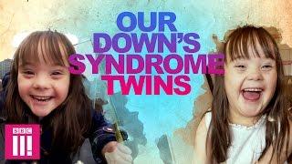 Our Downs Syndrome Twins  Living Differently