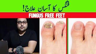 Dr. ZeeGet Rid Of Toenail Fungus A complete guide