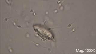 Human Sperm under the Microscope