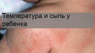 Температура и сыпь у ребенка