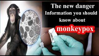 The new danger.. Information you should know about monkeypox