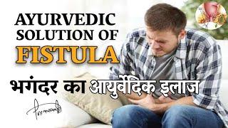 भगंदर का आयुर्वेदिक इलाज  Piles Fistula Ayurvedic Treatment By Nityanandam Shree in Hindi