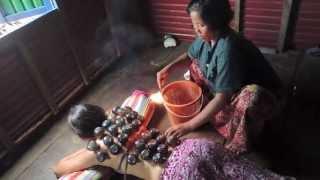 Cupping--Cambodian-style