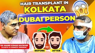 Hair Transplant Cost  Best Hair Transplant In Kolkata  Cosmo Aid