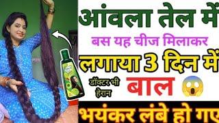 Dabur Amla oil मात्र 10 रूपये मैं रातों रात अपने बालों को कालालंबाघनामजबूत बनाएं Shanti Amla