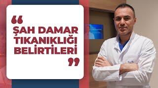 Şah Damar Karotis Arter Tıkanıklığı Belirtileri Nelerdir?  PROF. DR. MERT DUMANTEPE