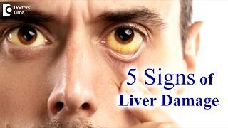 Liver disease Symptoms in adults. 5 Signs your liver is damaged - Dr. Ravindra B S  Doctors Circle