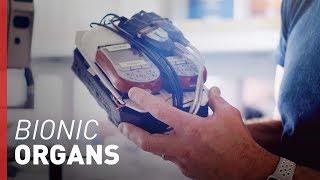 Father Creates Bionic Organ for Son  Freethink Superhuman