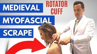 Muscle Scraping GRASTON TECHNIQUE for rotator cuff shoulder pain