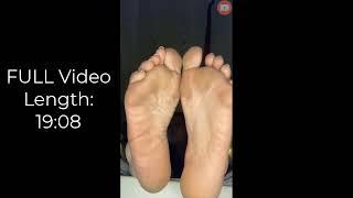 H Mature Welsh Moisturising Big Size 12 Soles & Dry Heels On Bed 7 PREVIEW