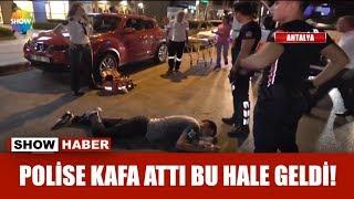 Polise kafa attı bu hale geldi