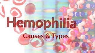 Hemophilia  Types & Casues  Blood Clotting Factors & Mechanism  Hemophilia & Joints