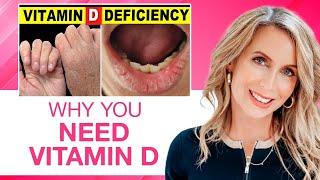 Why You NEED More Vitamin D To Help Reduce The Effects Of Aging  Cynthia Thurlow