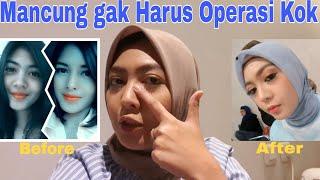 Tips Memancungkan Hidung Tanpa Operasi  VIRAL Cara Alami Hidung Mancung  NO CLICKBAIT