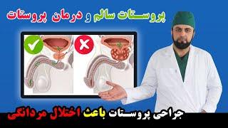 تداوی پروستات سالم، مشکلات نعوظ مردانه  Healthy Prostate Erectile Dysfunction Prostate Treatment