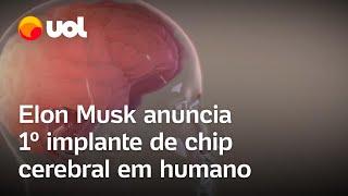 Elon Musk anuncia 1º implante de chip cerebral da Neuralink em ser humano