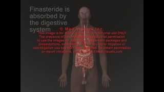 Finasteride Propecia & Proscar Side Effects Animation
