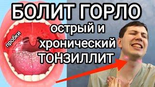 Как избавиться от гнойных пробок навсегда  Тонзиллит. Упражнения полоскание рекомендации