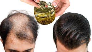 Hair grows like crazy and doesnt fall out Rosemary for fast hair growth