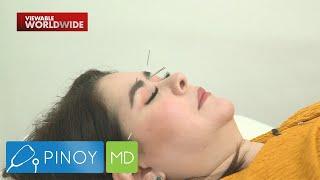 Connie Sison sinubukan ang whole body acupuncture  Pinoy MD