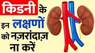 Kidney Kharab Hone Ke Lakshan - Kidney Failure Symptoms  किडनी खराब होने के लक्षण