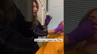 When injecting #lipfiller it’s not about how much you use but how you place it #shorts #medspa