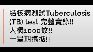 申請BNO VISA之前既準備 結核病測試Tuberculosis TB test 完整實錄 大概1000蚊 一星期搞掂