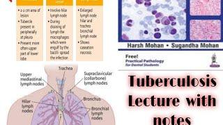 Tuberculosis infection ghons focus