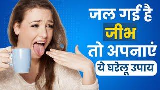 Tongue Burn Remedies गर्म खाने से जल गई जीभ? जल्द राहत देंगे ये घरेलू उपाए  The Health Site