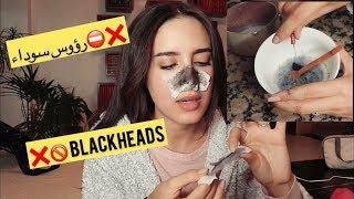 DIY BLACKHEAD peel off Mask  ️ DIY إزالة الرؤوس السوداء